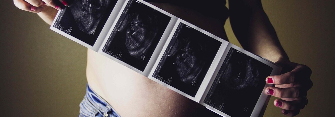 Kinderwunsch-Clinic Blog: Wissenswertes über die Schwangerschaft Schwangere Frau hält Ultraschallbilder ihres ungeborenen Kindes in den Händen
