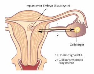Abbildung der Gebärmutter bei einer Schwangerschaft