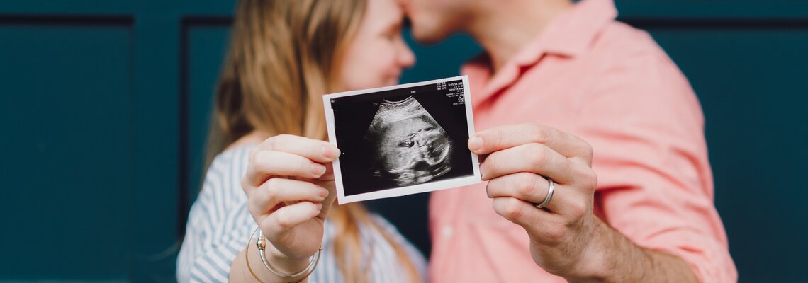 Ein Paar hält gemeinsam das Ultraschallbild der schwangeren Frau 