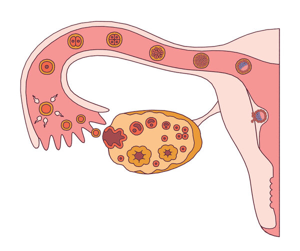 Grafische Darstellung eines Eisprungs, der Befruchtung und Einnistung