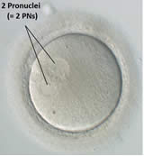 Mikroskopbild einer befruchteten Eizelle
